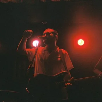 Sunburn